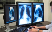 Analyzing x-ray or scann radiography_s