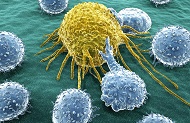 cancer_cells_limphosits_main