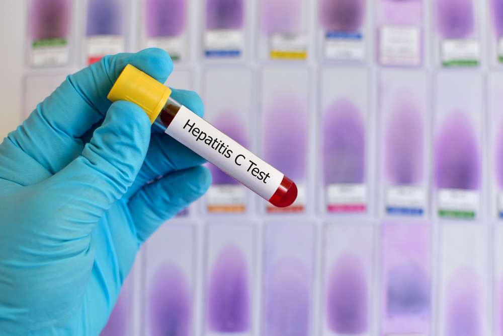 Проверка на гепатит - начало пути к исцелению